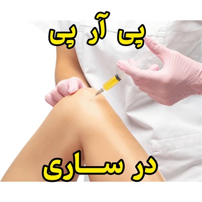 پی آر پی در ساری 