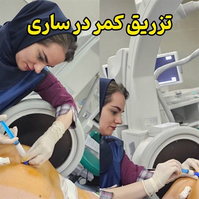 تزریق کمر در ساری