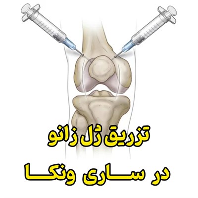 تزریق ژل زانو در ساری و نکا