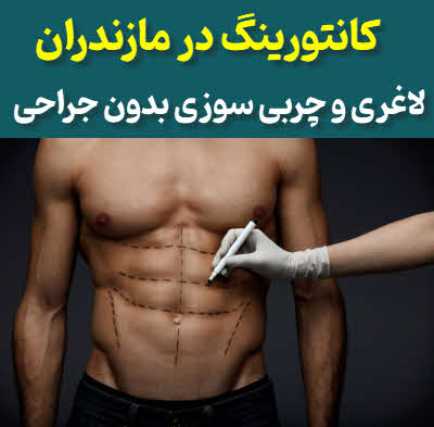 کانتورینگ مازندران