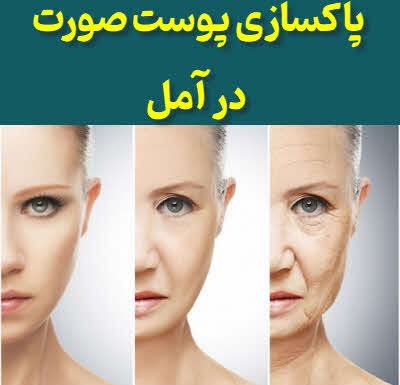 پاکسازی پوست آمل