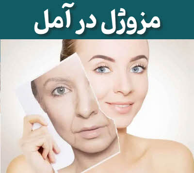 مزوژل آمل