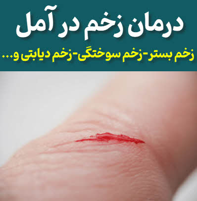 درمان انواع زخم آمل - زخم بستر|زخم سوختگی| زخم دیابتی