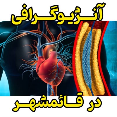 آنژیوگرافی در قائمشهر