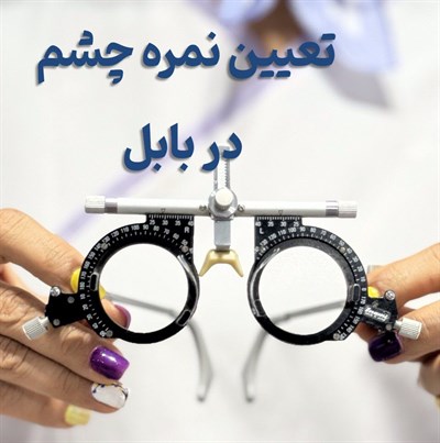 تعیین نمره چشم در بابل