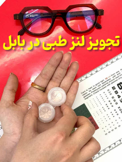 تجویز لنز طبی در بابل