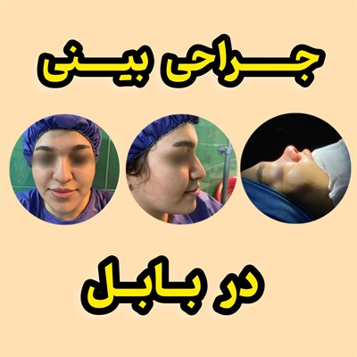 جراحی بینی در بابل