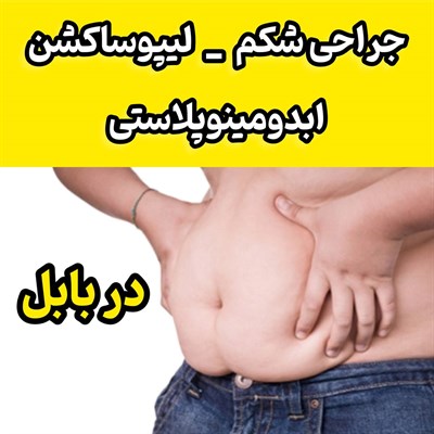 جراحی شکم در بابل