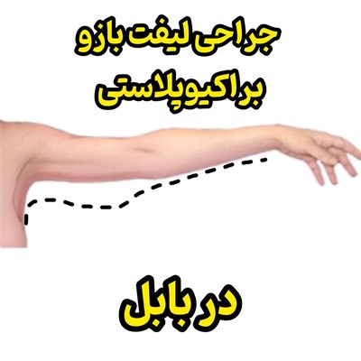 جراحی لیفت بازو (براکیوپلاستی) در بابل