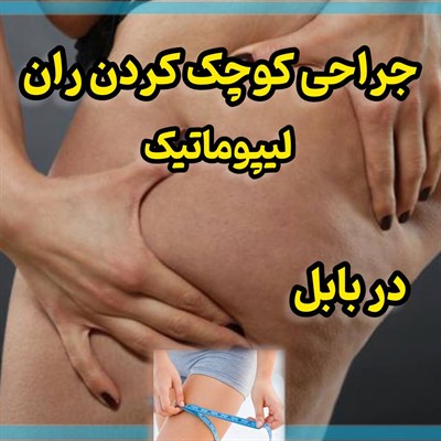 جراحی کوچک کردن ران(لیپوماتیک) در بابل