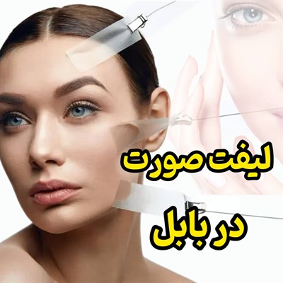 لیفت صورت در بابل