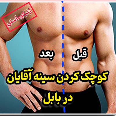 کوچک کردن سینه آقایان (ژنیکوماستی) در بابل