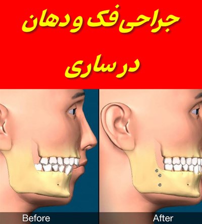 متخصص و جراح فک در ساری