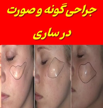 متخصص و جراح فک و صورت در ساری