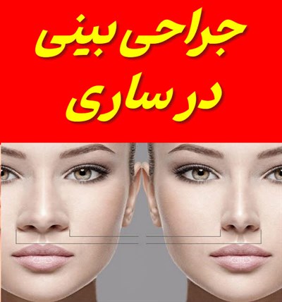جراحی بینی در ساری