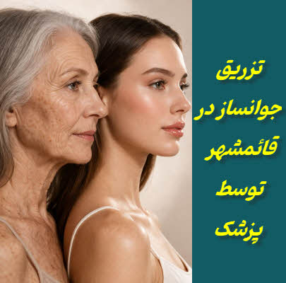 تزریق جوانساز در قائمشهر | PLLA(نخ مایع) و CaHA