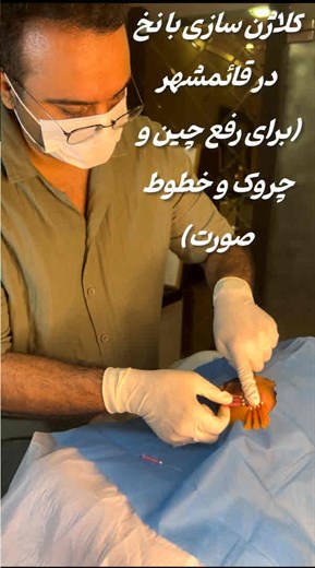 کلاژن سازی با نخ قائمشهر